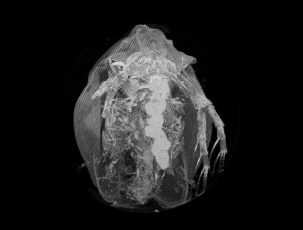 Maximum Intensity Projections, micro-CT